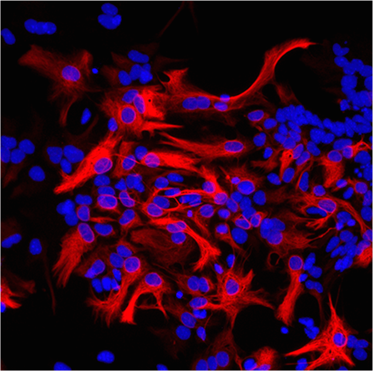 Astrocytes in culture